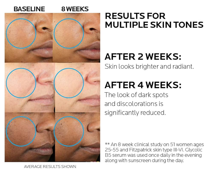 La Roche-Posay Glycolic B5 &ndash; сыворотка от пигментации с гликолевой кислотой, 30 мл 5736 фото